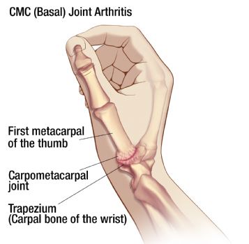 What type of joint is found at the base of the thumb?